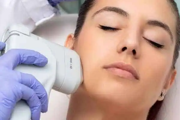 Image of woman having HIFU Billingshurst treatment
