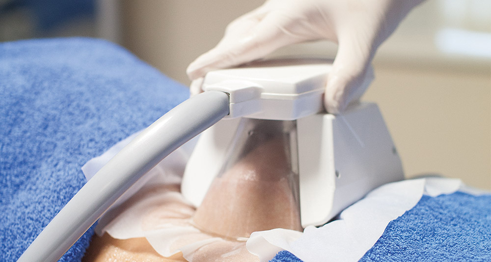 How Fat Freezing and HIFU Work Together? 2 Multiple Areas in One Session HIFU and Fat Freezing Billingshurst