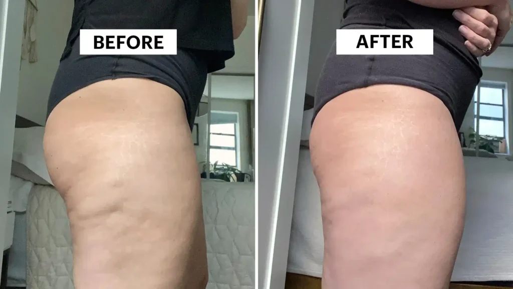 Do Toning Exercise Billingshurst Really Tackle Cellulite?