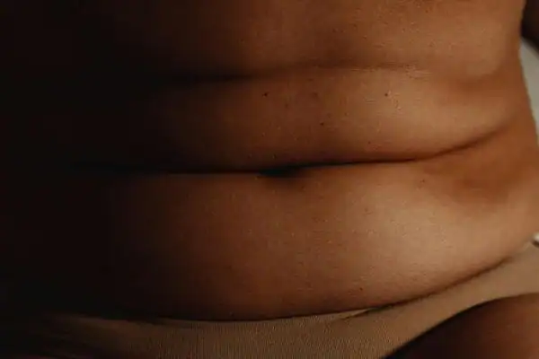 The Hidden Connection: How Stress Shapes Your Fitness and Body Composition 3 image of what stress can do on the stomach area and how Lipo 360 Billingshurst can help to change your body shape.