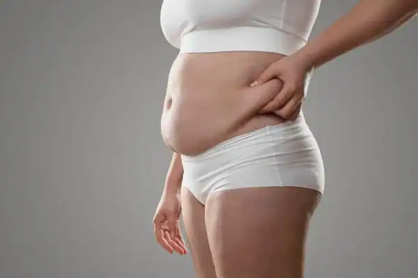 Image of stress belly Billingshurst How Lipo 360 can help manage your symptoms